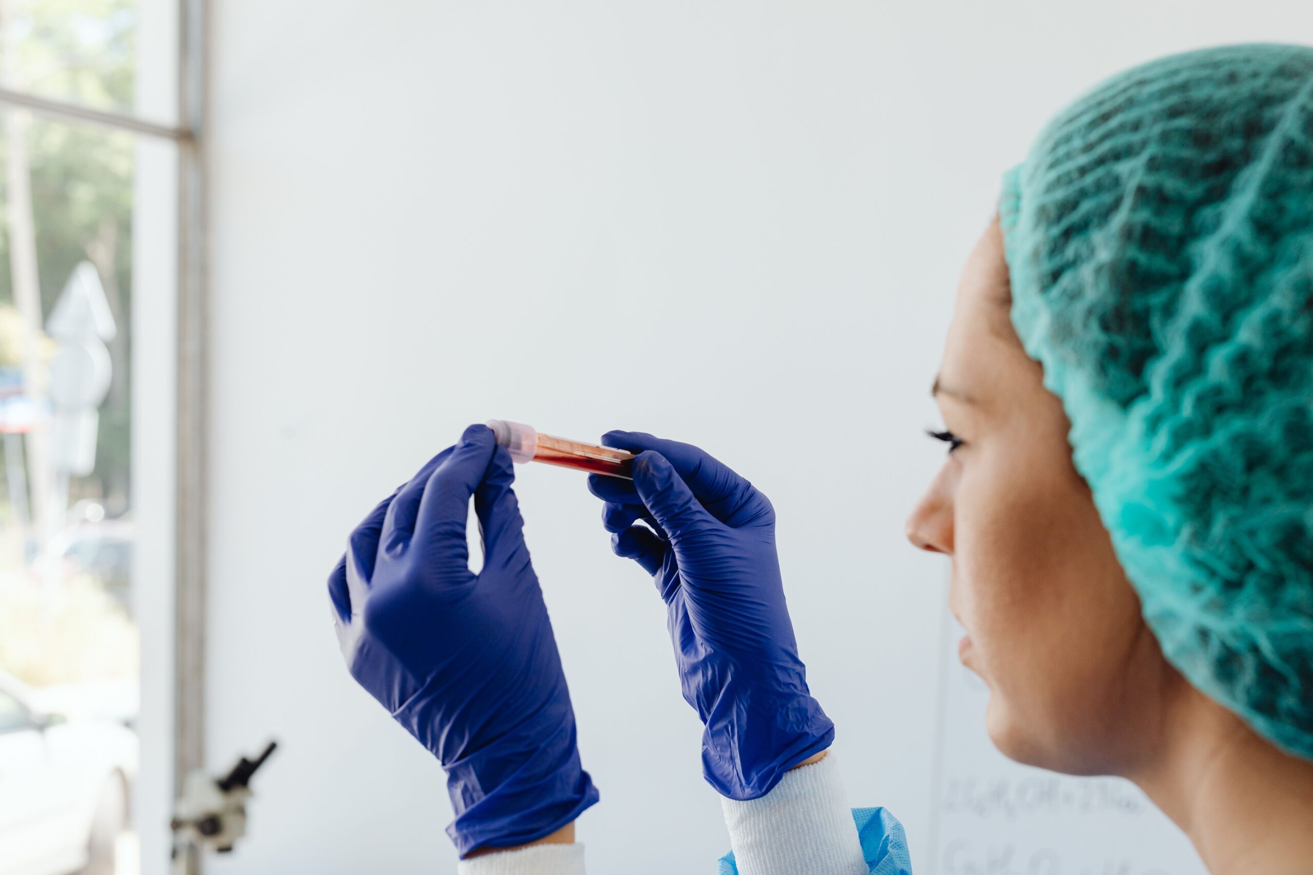 ALEX Test Wien – Laboruntersuchung einer Blutprobe