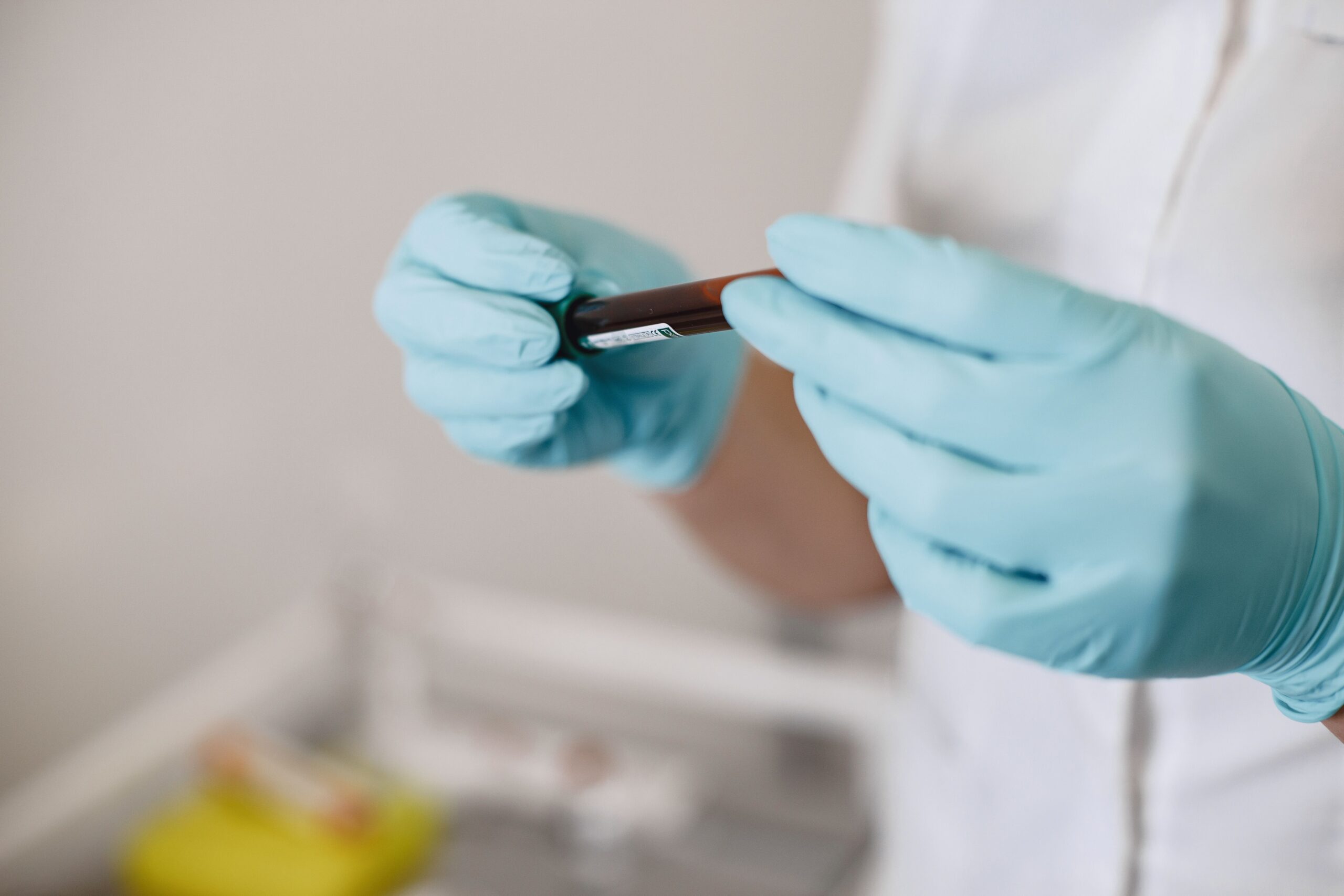 Blutprobe im Labor für einen Allergietest
